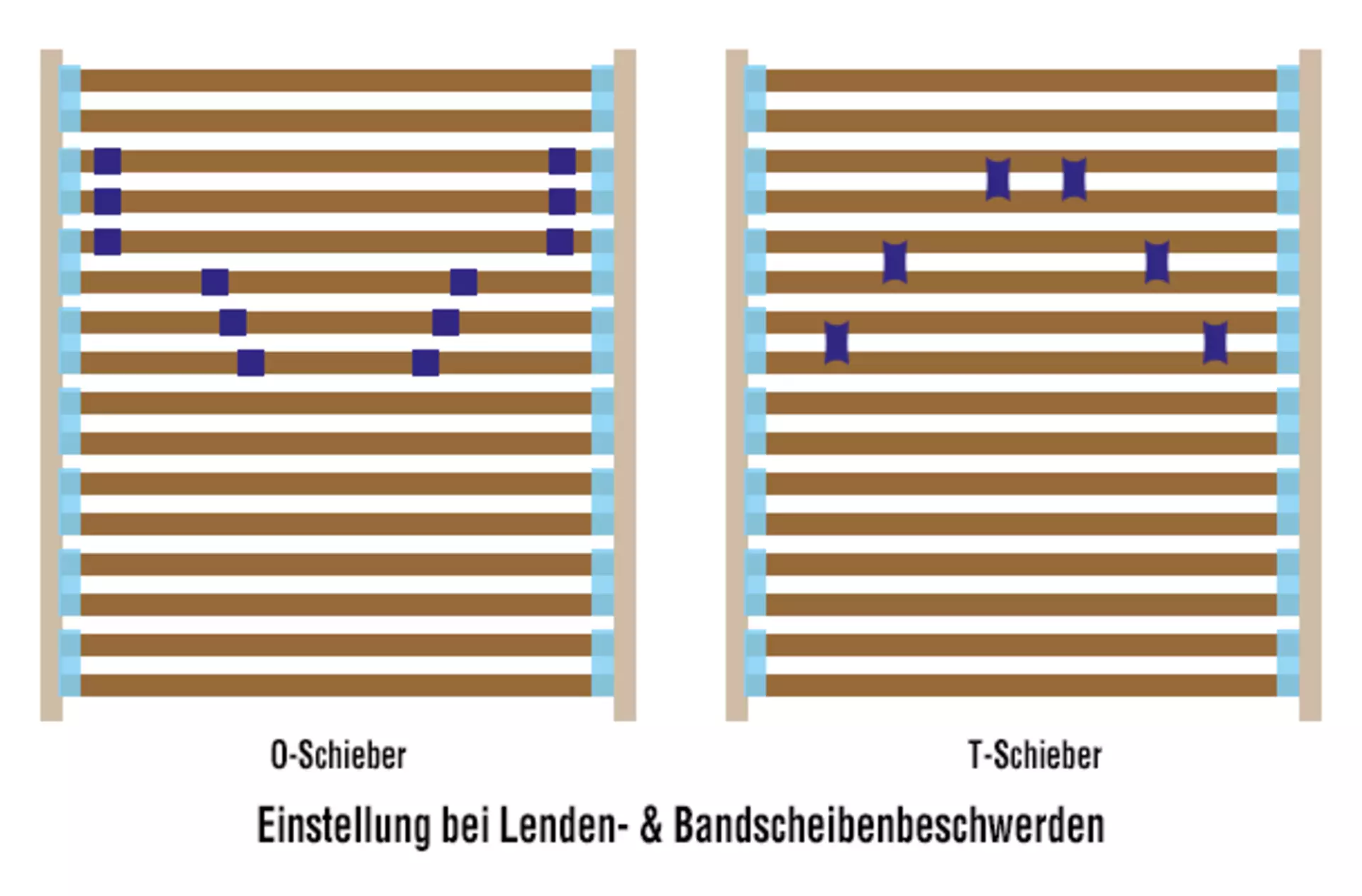 Beliebte Lattenrost-Einstellung für Rückenschläfer